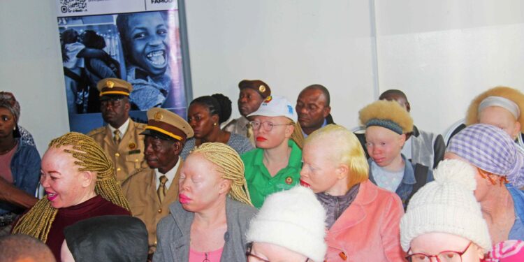 Alusivo ao Dia Internacional da Consciencialização sobre o Albinismo