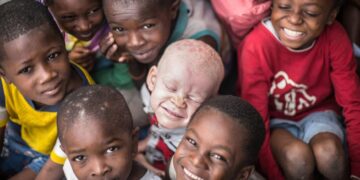 Pessoas com Albinismo em Moçambique: Políticas Públicas Existem, Mas São Apenas Letras Mortas