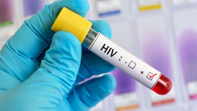 Em Cabo Delgado: Mais de 10 mil casos de HIV diagnosticados no primeiro semestre deste ano